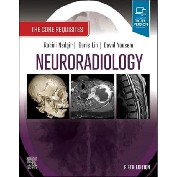 Amazon | Osborn's Brain | Osborn MD FACR, Anne G., Linscott MD